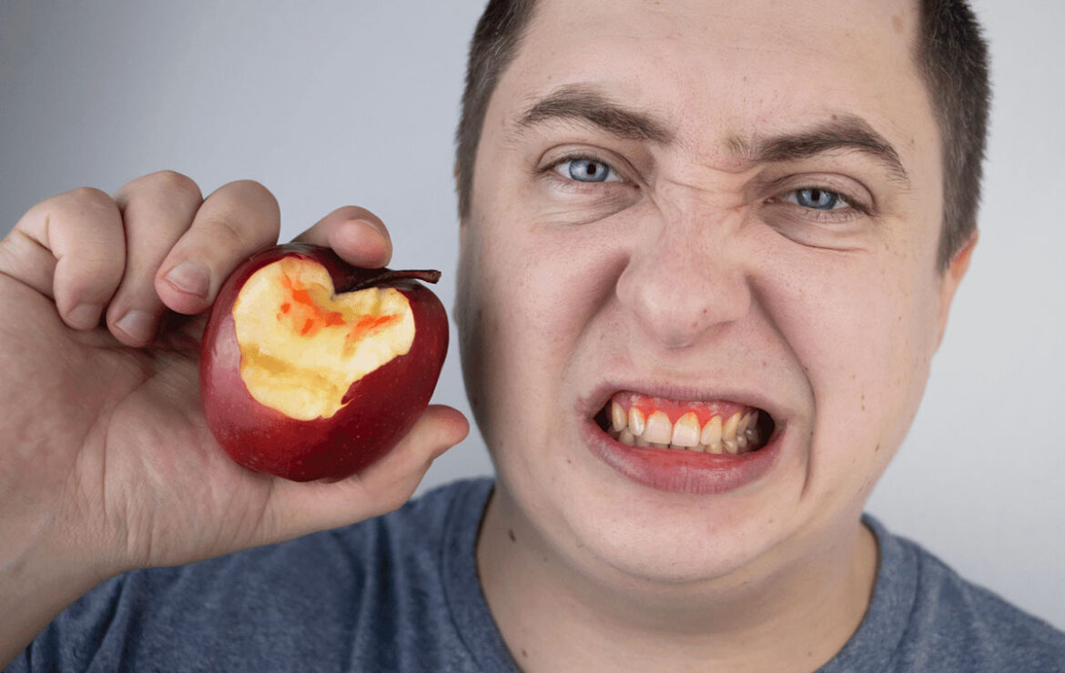 Are you faced with Bleeding Gums Cause and Treatments of Bleeding