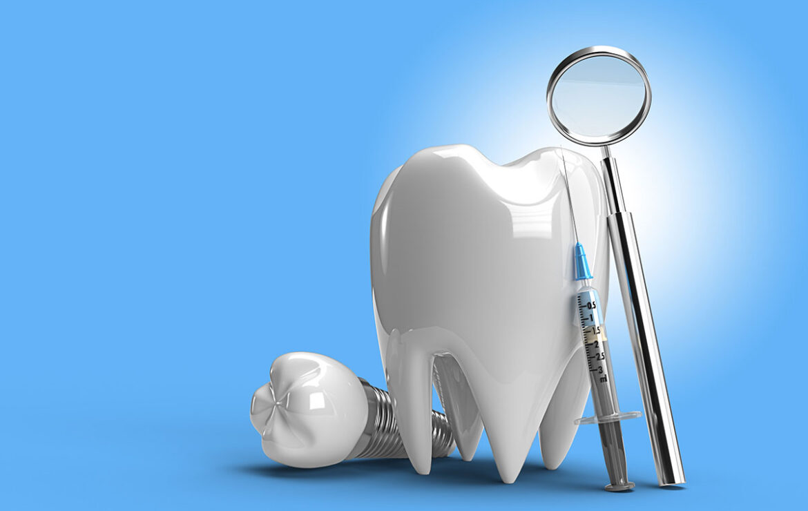 What is Dental Implant? Types and Benefits