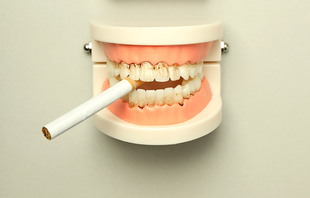 Gum Disease Treatments in Ahmedabad